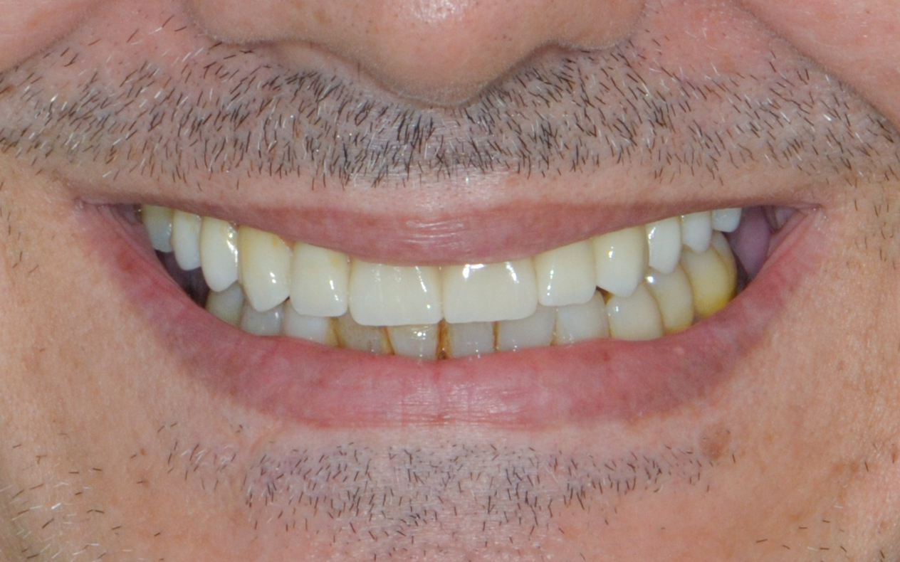 After